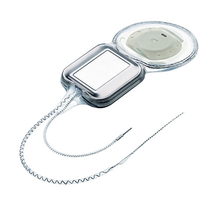 Cochlear™ Nucleus® Profile Plus mit Slim Straight Elektrode, Cochlear Ltd.